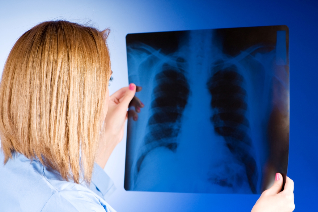 Pneumologové vyšetřili plíce 1 480 lidem, u pětiny z nich zjistili problém