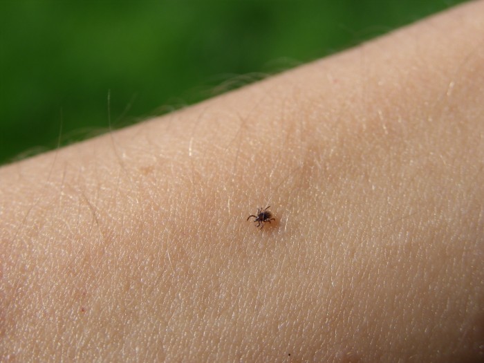 Kvůli teplu hrozí invaze
klíšťat, nechte se očkovat