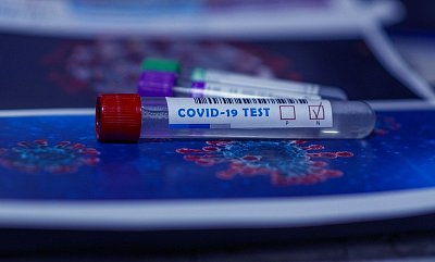 Jak se zařízení sociálních služeb dostanou k penězům od pojišťoven za antigenní testování? VoZP jim zdarma poskytuje aplikaci